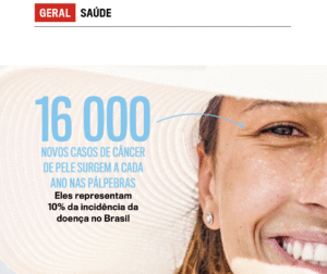 Casos de Câncer nas pálpebras