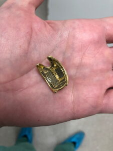 Placa de notch para tratamento do melanoma ocular