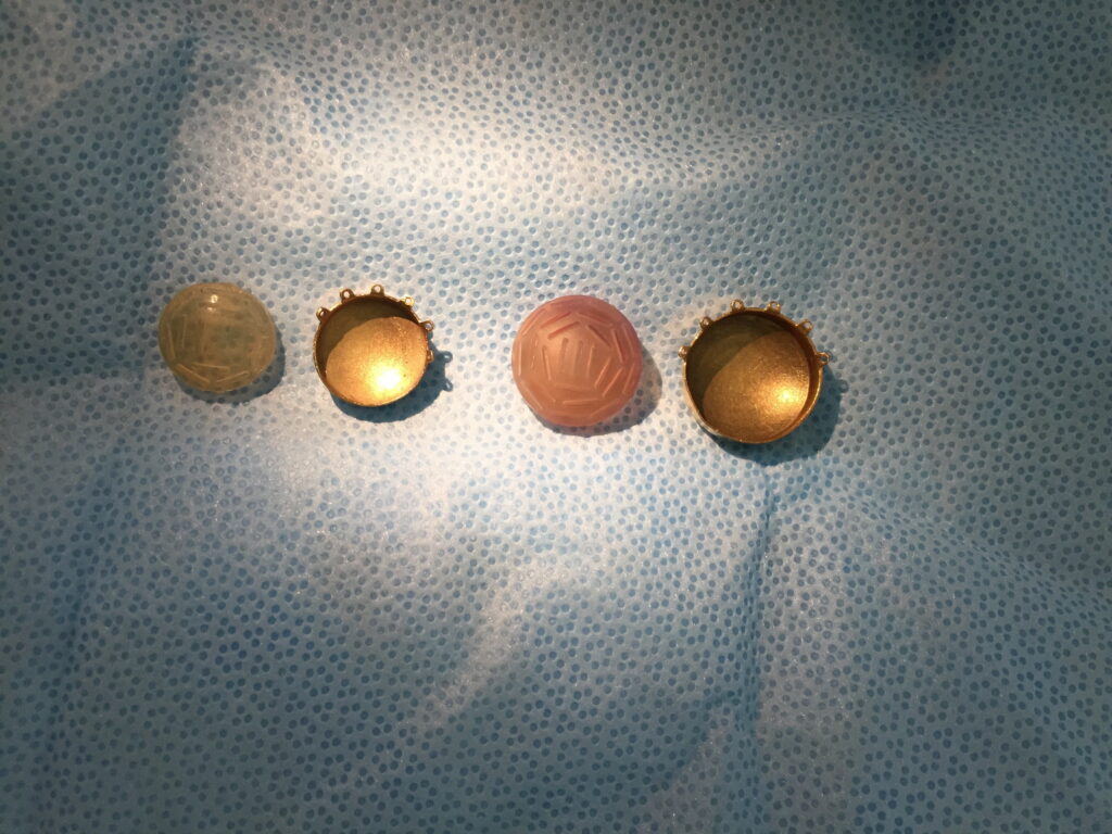 Placa de braquiterapia ocular